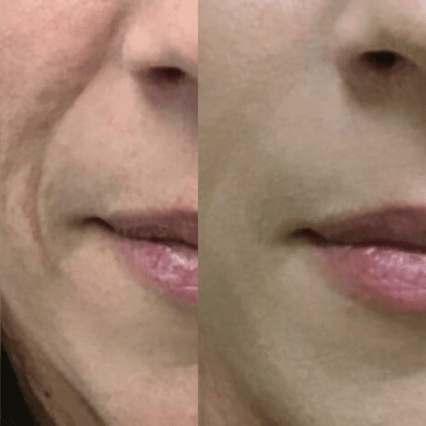 Preenchimento do Bigode Chinês - Imagem 3