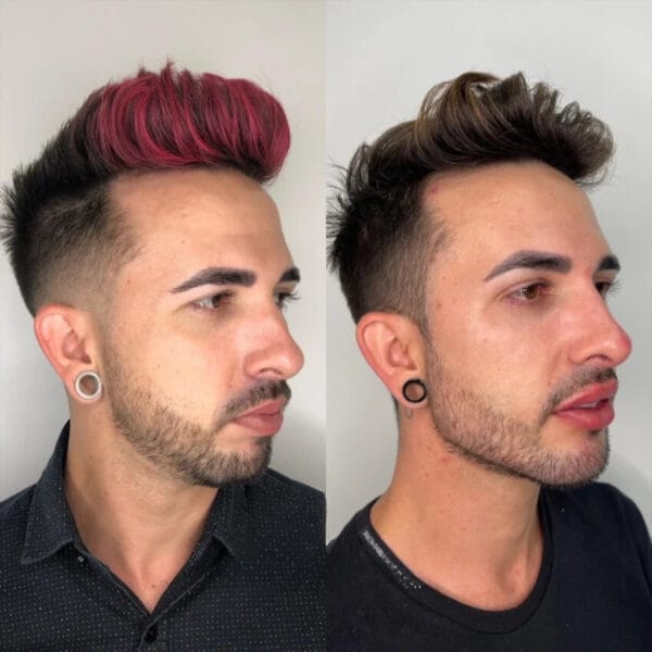 Preenchimento de Mandíbula - Imagem 2