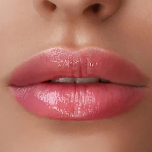 Preenchimento Labial com Ácido Hialurônico