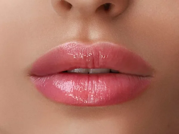 Preenchimento Labial com Ácido Hialurônico